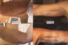 Body-Ultrasound-1
