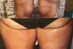 Body-Ultrasound-3