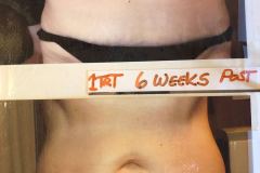 Body-Ultrasound-4
